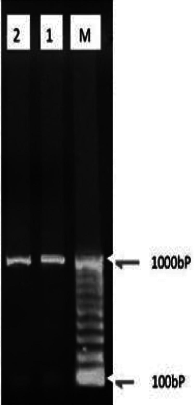https://cdn.ncbi.nlm.nih.gov/pmc/blobs/a07d/3655239/32b30ff1020e/IJPA-8-047-g005.jpg