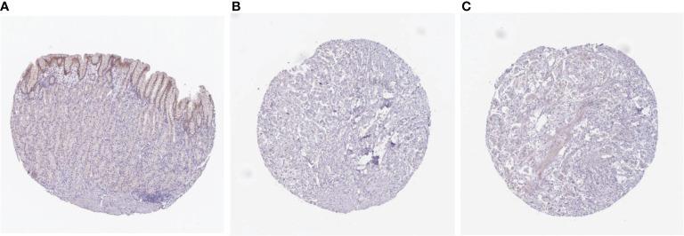 https://cdn.ncbi.nlm.nih.gov/pmc/blobs/a07f/9667298/f96b72f08bbd/fimmu-13-947802-g013.jpg