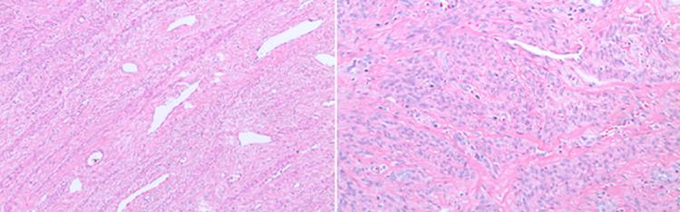 https://cdn.ncbi.nlm.nih.gov/pmc/blobs/a083/8896877/53a56c6b2966/cureus-0014-00000021845-i04.jpg