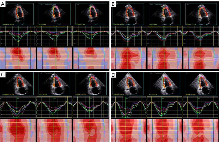 https://cdn.ncbi.nlm.nih.gov/pmc/blobs/a088/11994497/09b4cf1d0280/qims-15-04-3749-f6.jpg