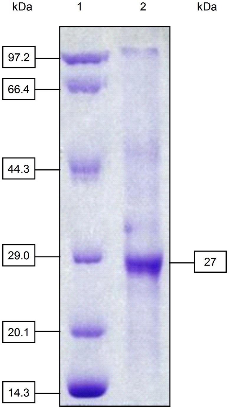 https://cdn.ncbi.nlm.nih.gov/pmc/blobs/a08d/3989197/44cdc4a816b1/pone.0094543.g002.jpg