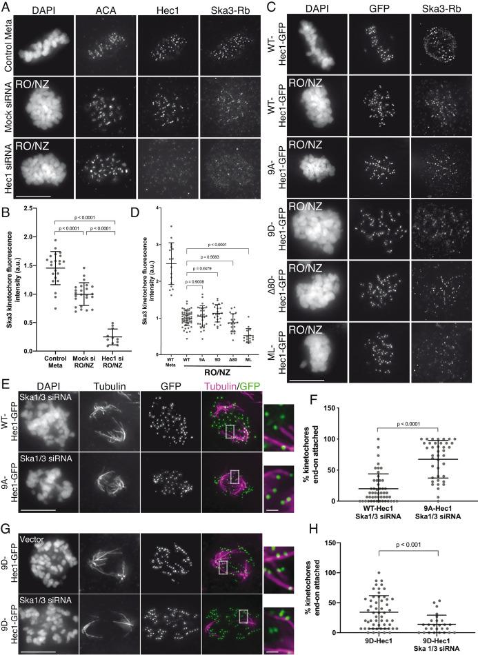 https://cdn.ncbi.nlm.nih.gov/pmc/blobs/a08f/7359571/4aa86d8c908e/mbc-31-1453-g002.jpg