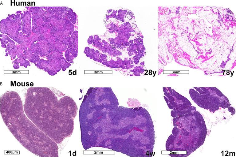 https://cdn.ncbi.nlm.nih.gov/pmc/blobs/a09b/8100025/d1bec96363cf/fimmu-12-676236-g003.jpg