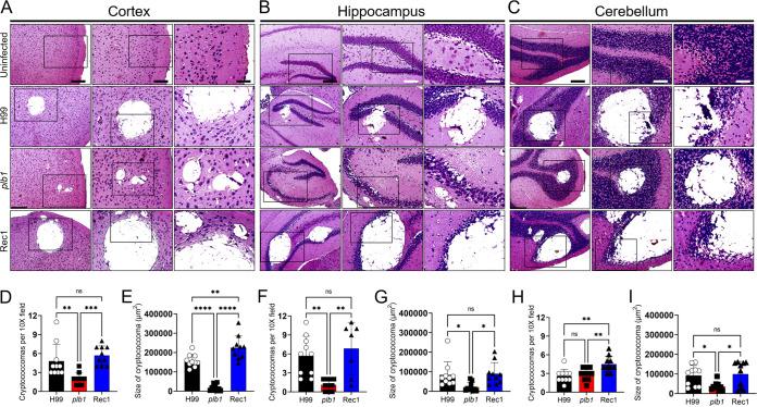 https://cdn.ncbi.nlm.nih.gov/pmc/blobs/a0a4/10127605/f51f4705c5ff/mbio.02640-22-f002.jpg
