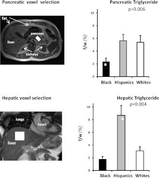 https://cdn.ncbi.nlm.nih.gov/pmc/blobs/a0a9/3476895/52e0079b68da/2377fig1.jpg