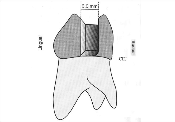 https://cdn.ncbi.nlm.nih.gov/pmc/blobs/a0b3/2883801/e21fcced43c2/JCD-13-09-g002.jpg