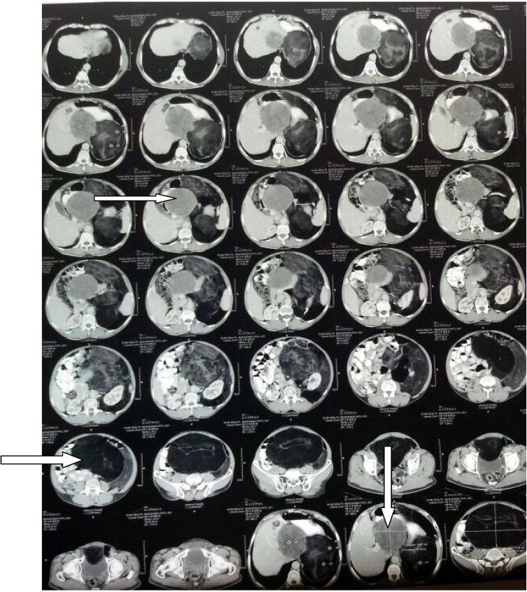https://cdn.ncbi.nlm.nih.gov/pmc/blobs/a0b8/4064398/dca04848493e/gr1.jpg