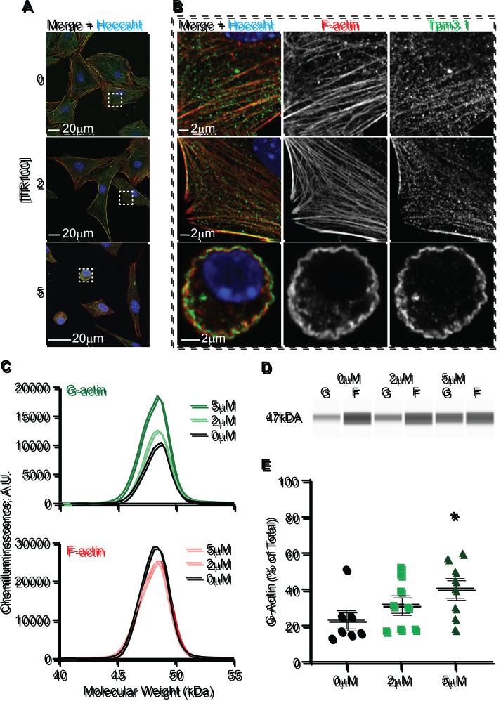 https://cdn.ncbi.nlm.nih.gov/pmc/blobs/a0b9/9727789/837e05cd2f67/mbc-33-ar141-g005.jpg