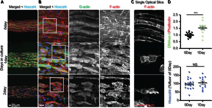 https://cdn.ncbi.nlm.nih.gov/pmc/blobs/a0b9/9727789/d0a1204b6abe/mbc-33-ar141-g002.jpg