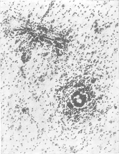 https://cdn.ncbi.nlm.nih.gov/pmc/blobs/a0c8/1061379/01bb79f9e289/jnnpsyc00334-0074-b.jpg