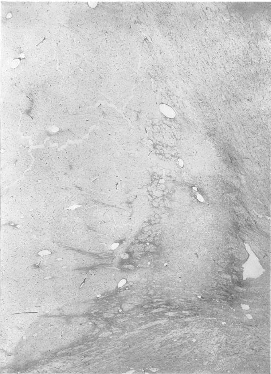 https://cdn.ncbi.nlm.nih.gov/pmc/blobs/a0c8/1061379/443360150079/jnnpsyc00334-0072-a.jpg