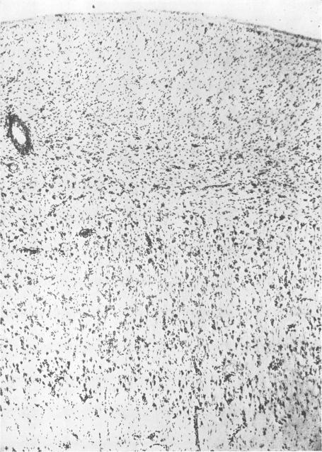 https://cdn.ncbi.nlm.nih.gov/pmc/blobs/a0c8/1061379/9f3ff75cb17a/jnnpsyc00334-0065-a.jpg