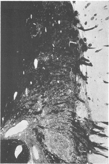 https://cdn.ncbi.nlm.nih.gov/pmc/blobs/a0c8/1061379/fe82213a08c9/jnnpsyc00334-0063-a.jpg