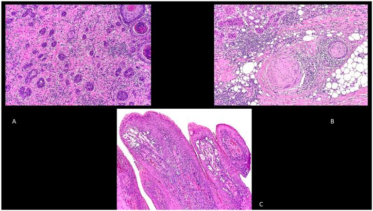 https://cdn.ncbi.nlm.nih.gov/pmc/blobs/a0cb/7916193/a1dc78b41740/biomedicines-09-00171-g003.jpg