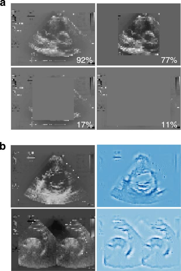 https://cdn.ncbi.nlm.nih.gov/pmc/blobs/a0cc/6548341/1752d314f7d7/41746_2017_13_Fig6_HTML.jpg