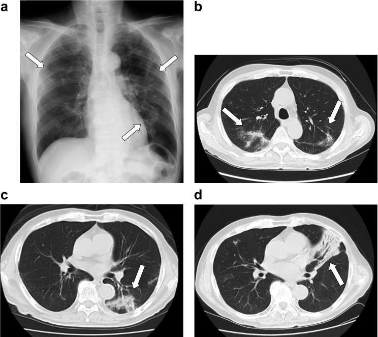 https://cdn.ncbi.nlm.nih.gov/pmc/blobs/a0f6/5721298/efed2691bc47/jrm-12-130-g001.jpg