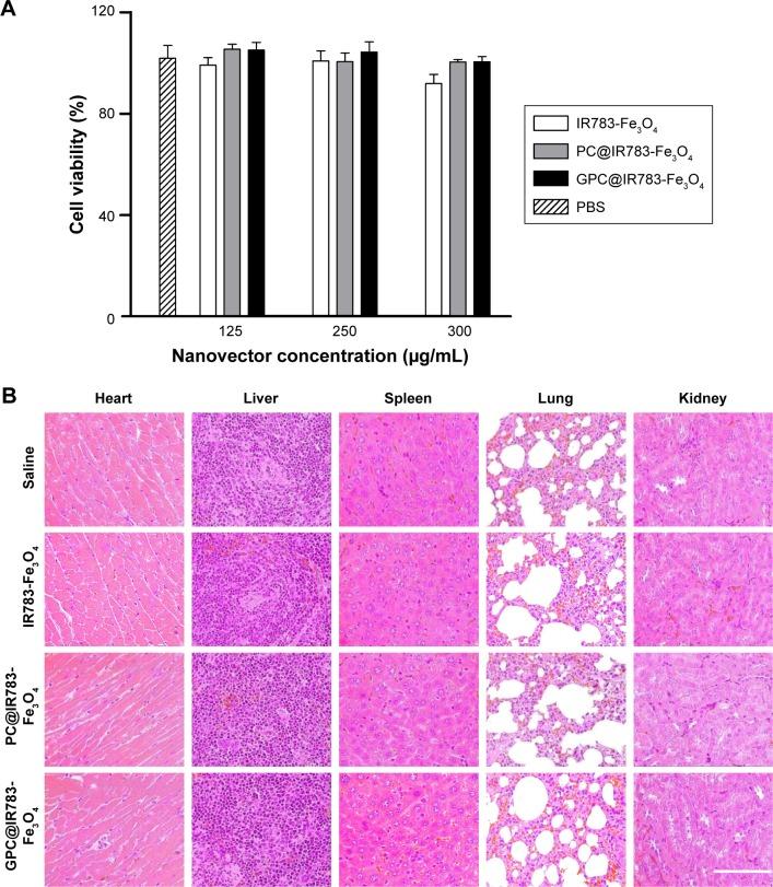 https://cdn.ncbi.nlm.nih.gov/pmc/blobs/a0f8/5358985/4734c61fa7f0/ijn-12-2033Fig7.jpg