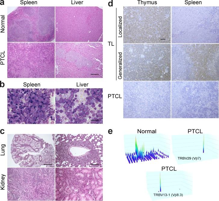 https://cdn.ncbi.nlm.nih.gov/pmc/blobs/a0fc/4854725/9bc39a43fe5c/JEM_20150794_Fig2.jpg