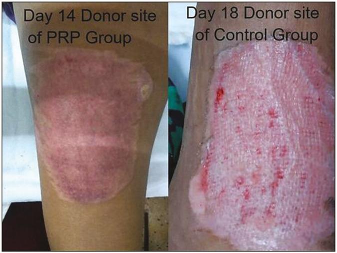 https://cdn.ncbi.nlm.nih.gov/pmc/blobs/a0fe/11086927/1bb21e2e2d53/JCAS-17-50-g003.jpg