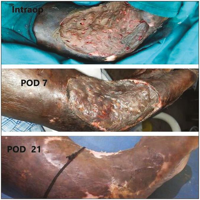 https://cdn.ncbi.nlm.nih.gov/pmc/blobs/a0fe/11086927/f4dff87977eb/JCAS-17-50-g002.jpg