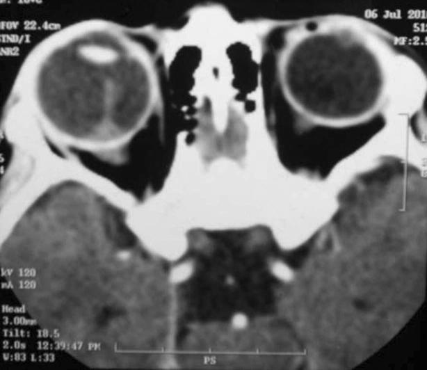https://cdn.ncbi.nlm.nih.gov/pmc/blobs/a0ff/5436372/fefe5ed6dc0c/gr2.jpg