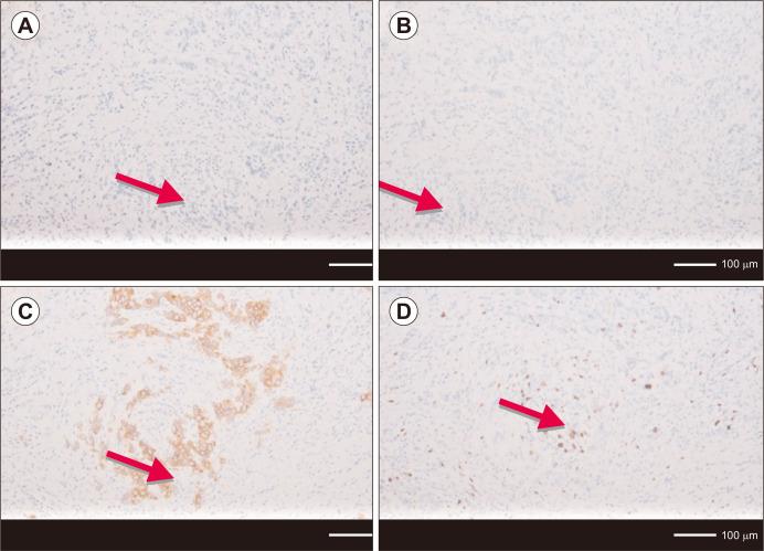 https://cdn.ncbi.nlm.nih.gov/pmc/blobs/a112/10331035/02de673cf41f/jcp-28-2-64-f2.jpg