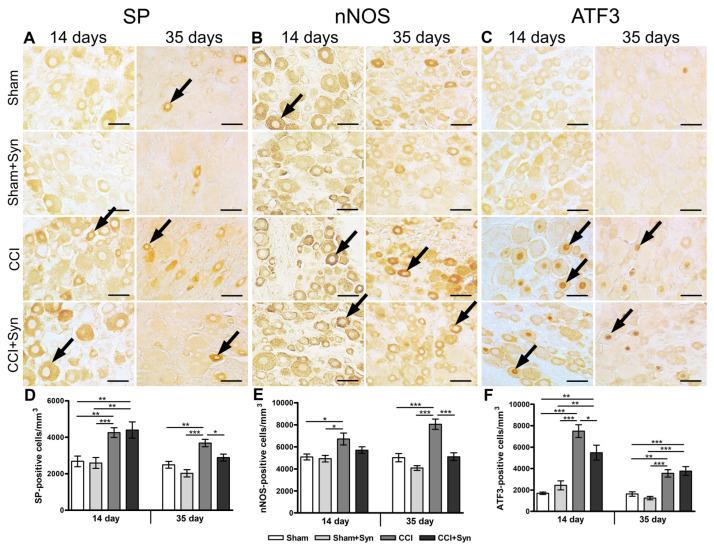 https://cdn.ncbi.nlm.nih.gov/pmc/blobs/a114/10093792/4f0dc4ac8cfb/ijms-24-06273-g006.jpg