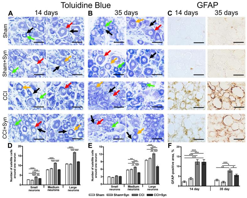https://cdn.ncbi.nlm.nih.gov/pmc/blobs/a114/10093792/aeb5f511bbf6/ijms-24-06273-g004.jpg
