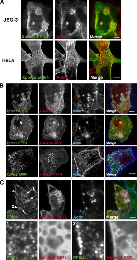 https://cdn.ncbi.nlm.nih.gov/pmc/blobs/a116/2064679/511056556d5a/jcb1750803f06.jpg