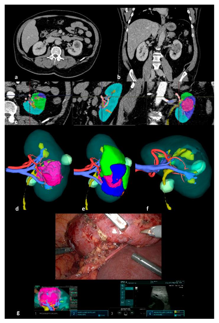 https://cdn.ncbi.nlm.nih.gov/pmc/blobs/a118/12248779/ad7e3be26029/cancers-17-02127-g001.jpg