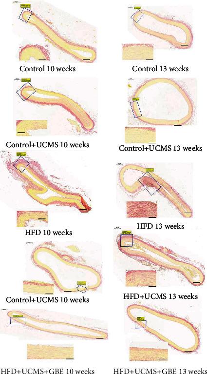 https://cdn.ncbi.nlm.nih.gov/pmc/blobs/a11e/9168192/3211492ebf59/MI2022-2408598.003.jpg