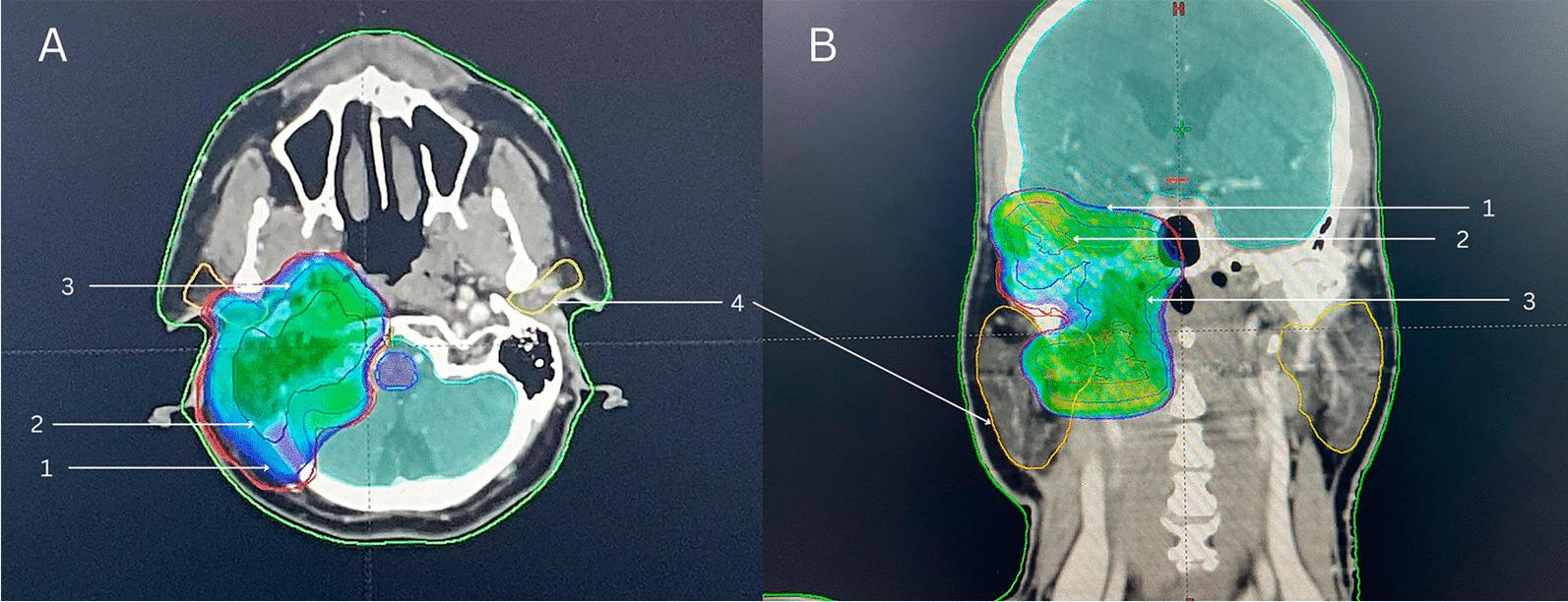 https://cdn.ncbi.nlm.nih.gov/pmc/blobs/a123/11165813/9ae2fc2aac93/13256_2024_4601_Fig3_HTML.jpg