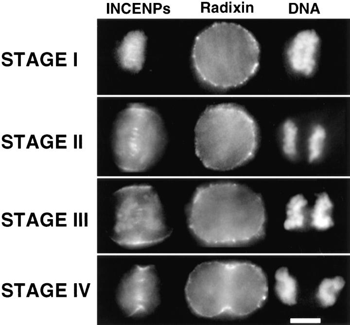 https://cdn.ncbi.nlm.nih.gov/pmc/blobs/a13a/2132506/578218cbfd9d/JCB.eckley8.jpg
