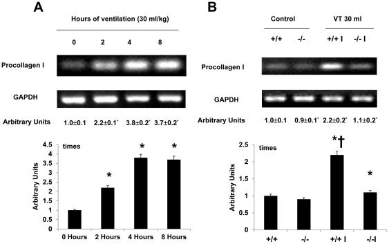 https://cdn.ncbi.nlm.nih.gov/pmc/blobs/a13e/3170381/57976bc2655b/pone.0024692.g004.jpg