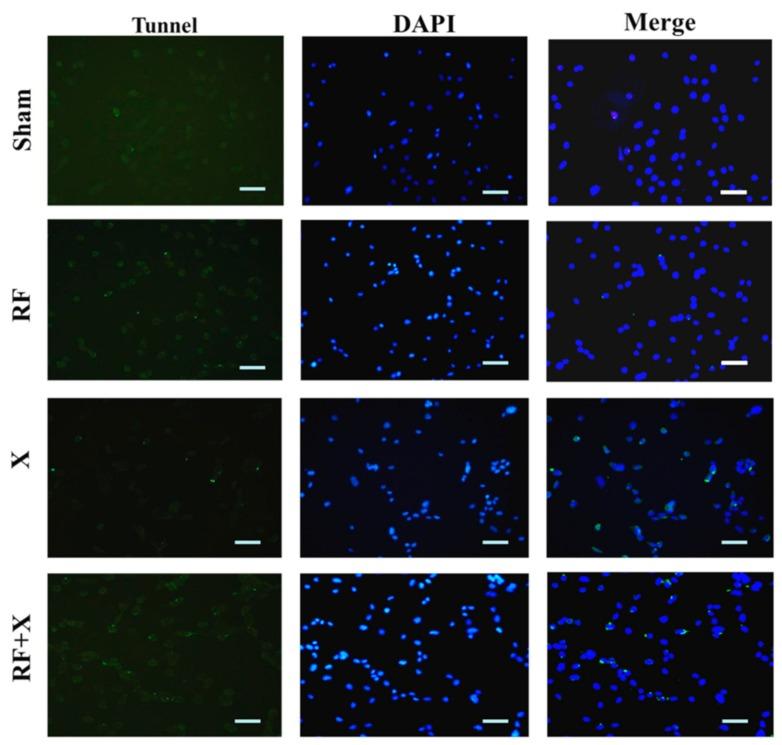 https://cdn.ncbi.nlm.nih.gov/pmc/blobs/a13e/5486302/c570de9d51fe/ijerph-14-00616-g004.jpg