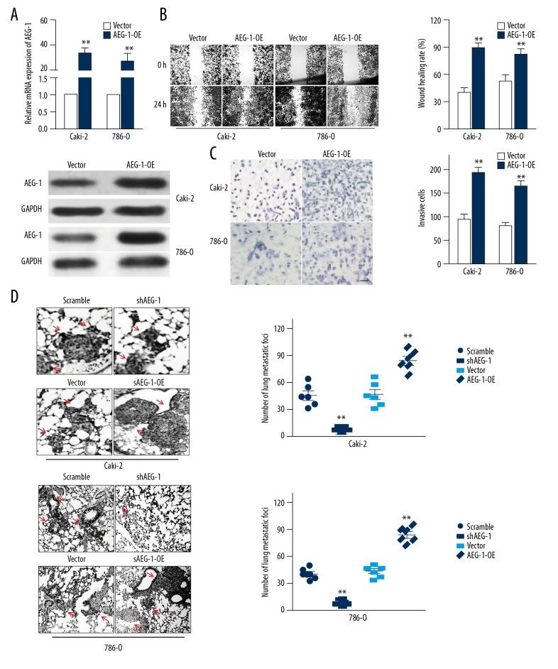 https://cdn.ncbi.nlm.nih.gov/pmc/blobs/a142/6253984/45692205b6f5/medscimonit-24-8213-g003.jpg
