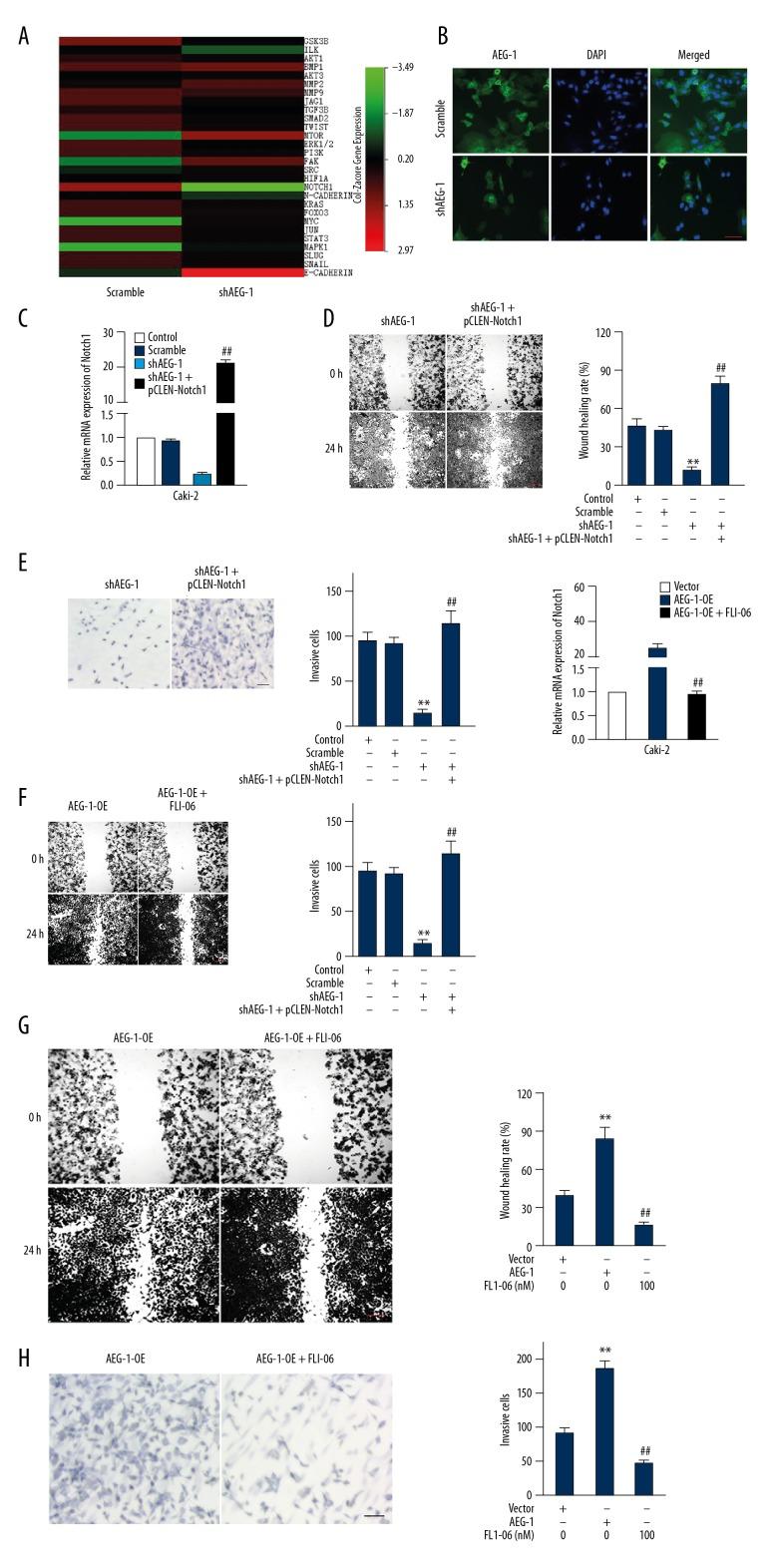 https://cdn.ncbi.nlm.nih.gov/pmc/blobs/a142/6253984/9776f15aef86/medscimonit-24-8213-g004.jpg