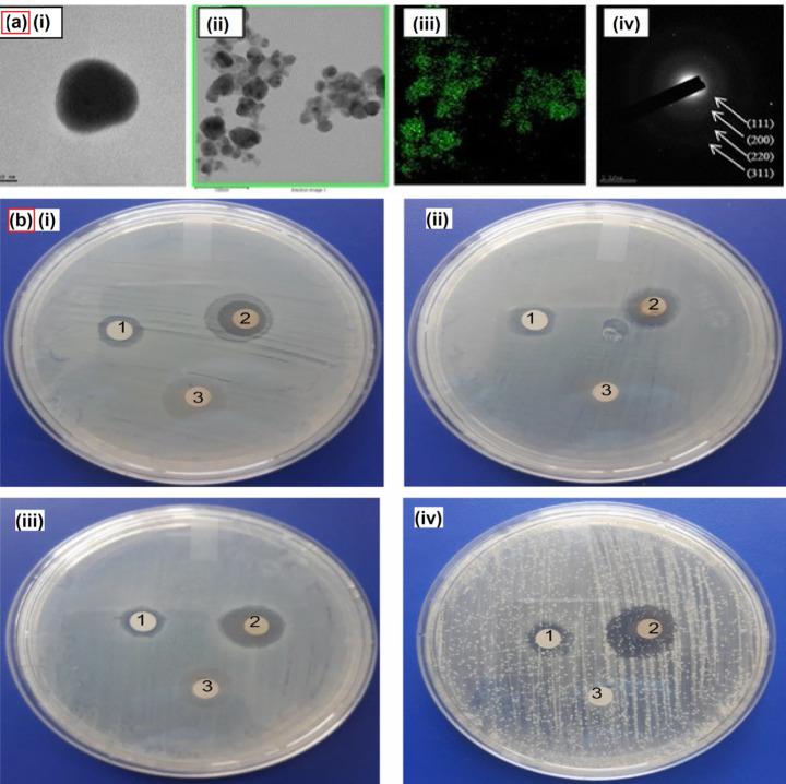 https://cdn.ncbi.nlm.nih.gov/pmc/blobs/a14a/11166857/06e493a71480/12010_2023_4719_Fig4_HTML.jpg