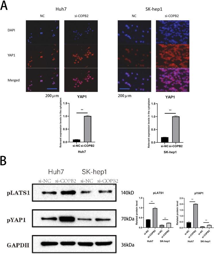 https://cdn.ncbi.nlm.nih.gov/pmc/blobs/a14c/11964868/6ab2af6b12f4/OncolRes-33-58085-f008.jpg