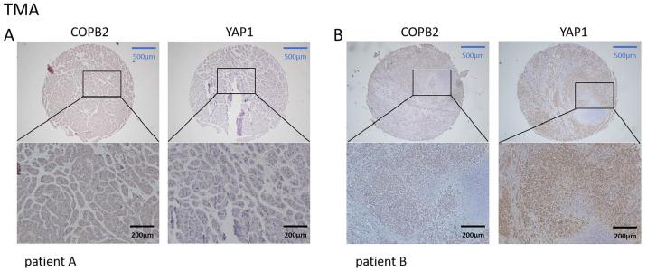 https://cdn.ncbi.nlm.nih.gov/pmc/blobs/a14c/11964868/e8c1fbd82e92/OncolRes-33-58085-f002.jpg
