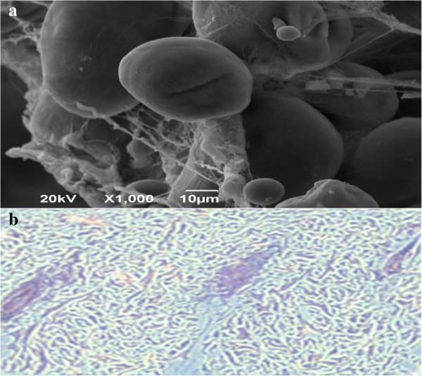 https://cdn.ncbi.nlm.nih.gov/pmc/blobs/a150/3986932/daa620778a7c/1471-2407-14-220-11.jpg