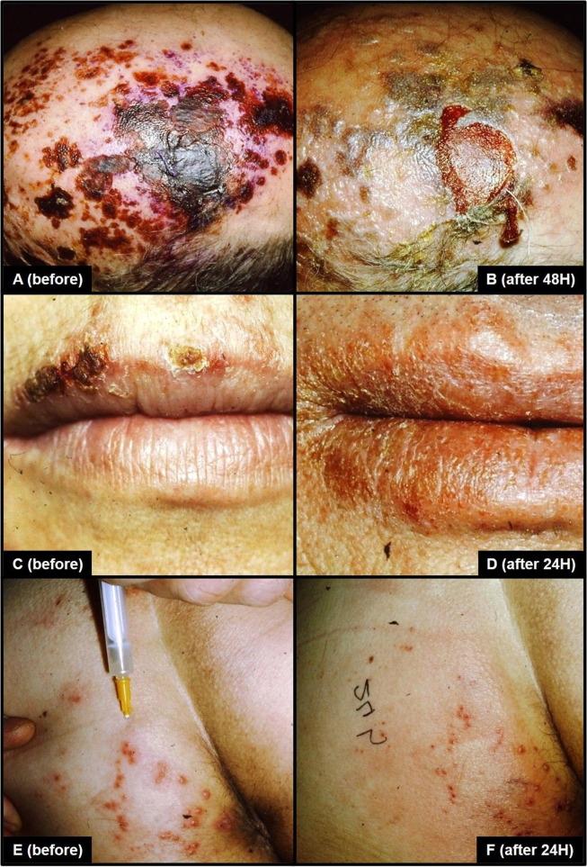 https://cdn.ncbi.nlm.nih.gov/pmc/blobs/a157/7546174/6f80d41102b6/gr1_lrg.jpg