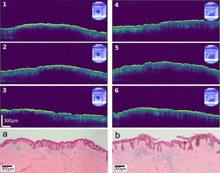 https://cdn.ncbi.nlm.nih.gov/pmc/blobs/a15c/12411026/d30dbdadac8f/JBIO-18-e70040-g011.jpg