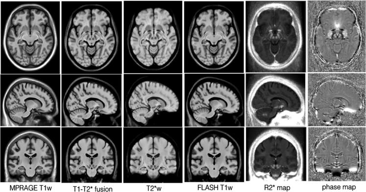 https://cdn.ncbi.nlm.nih.gov/pmc/blobs/a15f/5413210/a008c44bf5e5/gr1.jpg