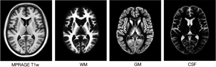 https://cdn.ncbi.nlm.nih.gov/pmc/blobs/a15f/5413210/d8f59fe3e6db/gr2.jpg