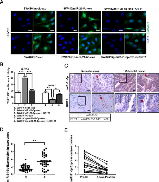 https://cdn.ncbi.nlm.nih.gov/pmc/blobs/a164/8178321/9dad78b6c0b4/41419_2021_3803_Fig5_HTML.jpg