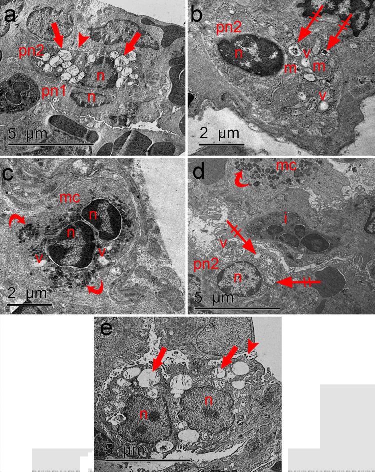 https://cdn.ncbi.nlm.nih.gov/pmc/blobs/a164/9287250/f48fbc25591f/441_2022_3627_Fig10_HTML.jpg
