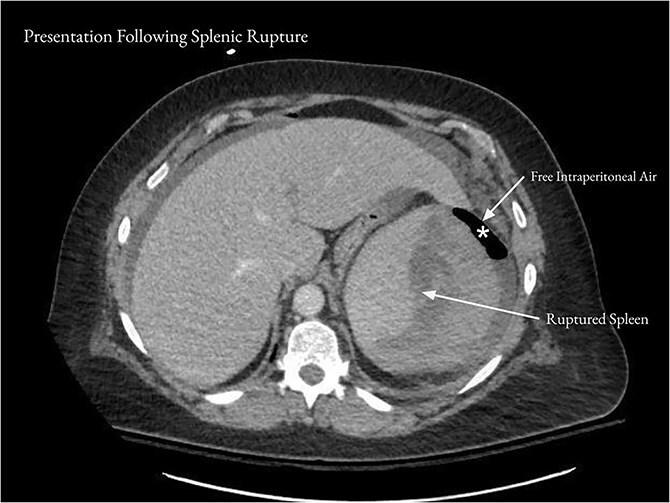 https://cdn.ncbi.nlm.nih.gov/pmc/blobs/a166/12188192/22be789ef2de/rjaf442f2.jpg