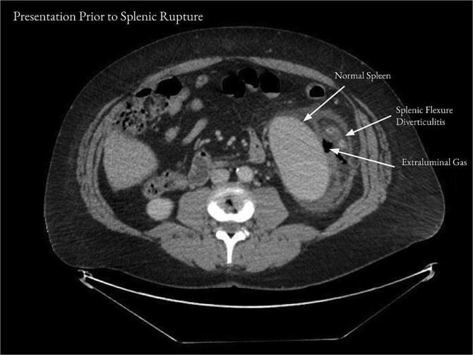 https://cdn.ncbi.nlm.nih.gov/pmc/blobs/a166/12188192/c871f5d9f429/rjaf442f1.jpg