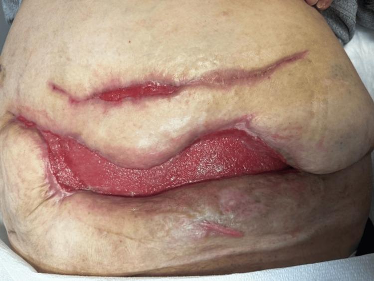https://cdn.ncbi.nlm.nih.gov/pmc/blobs/a169/11285656/7b3d3c39a3d5/cureus-0016-00000063470-i06.jpg